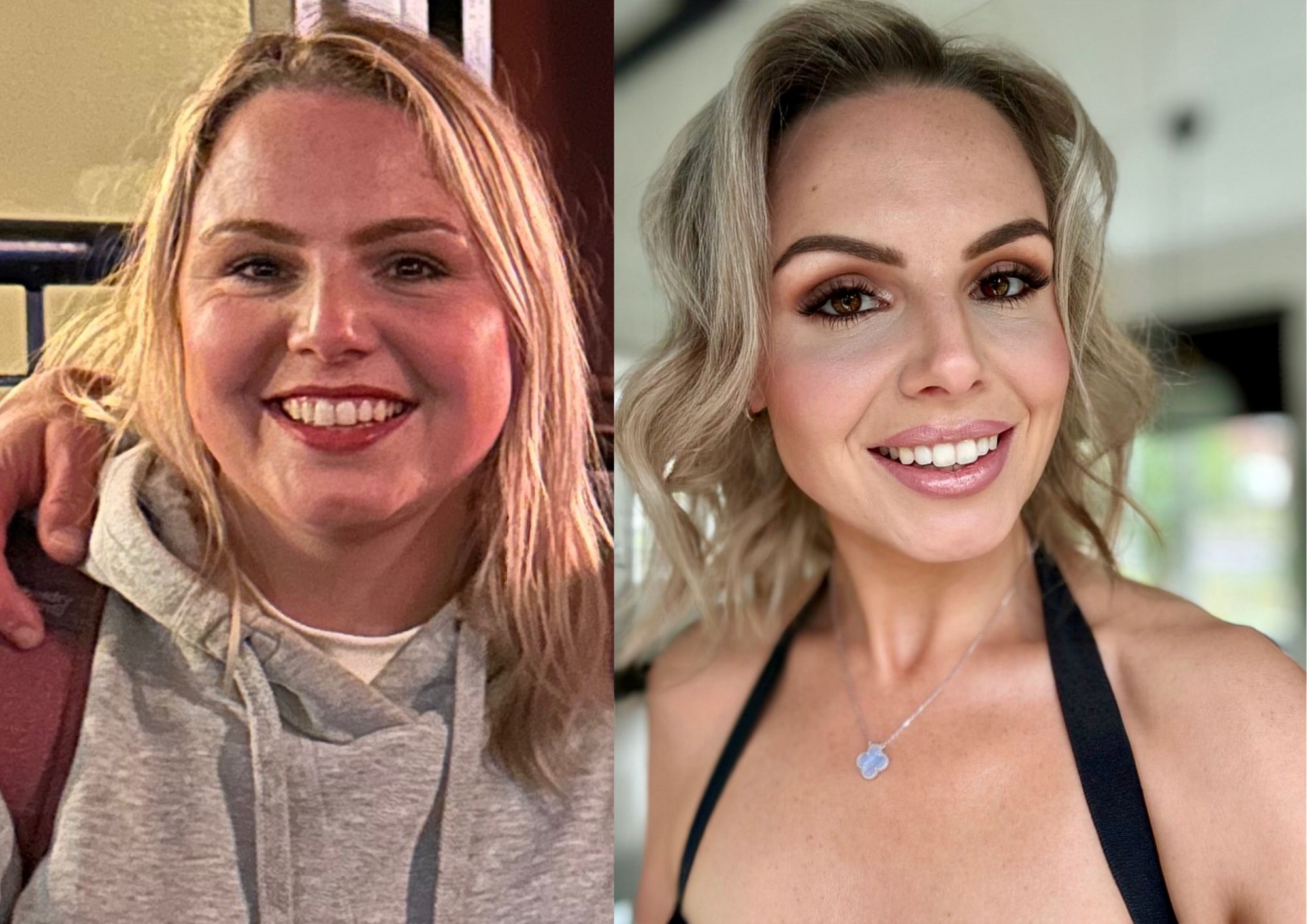Before and after face image after losing 7 stone blonde woman headshot